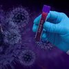 Испытания лекарств от коронавируса: в МОЗ раскрыли детали 
