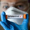 Коронавирус разрешили лечить лекарствами без регистрации до 2021