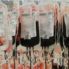 Из Украины запретили вывозить кровь