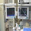 Реабілітація трансплантації: як поставити на потік пересадку органів в Україні