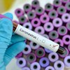 В Японии обнаружили антитела, нейтрализующие коронавирус
