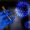 В Украине резко увеличилось количество случаев коронавируса