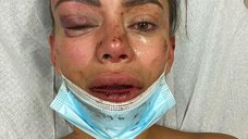 Мужчина зверски избил модель на вечеринке 