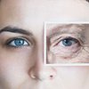 Преждевременное старение кожи вокруг глаз: как избежать