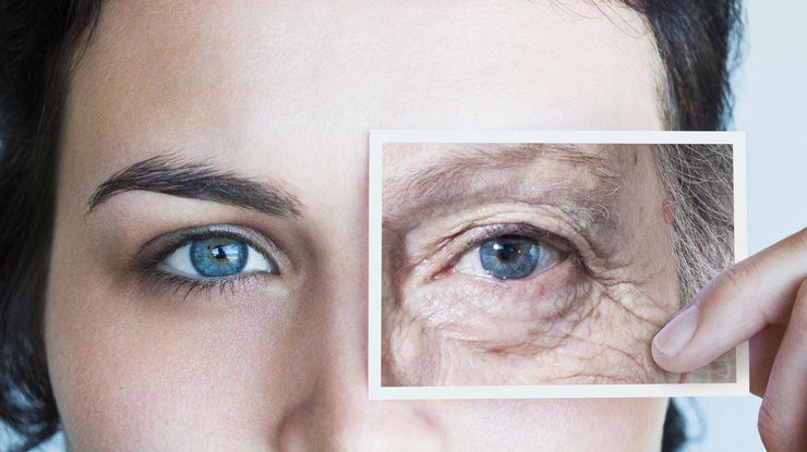 Старение кожи вокруг глаз/ Фото: pinterest.com