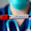 Украина установила сразу два антирекорда по коронавирусу
