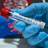 В Украине "упало" число инфицированных коронавирусом