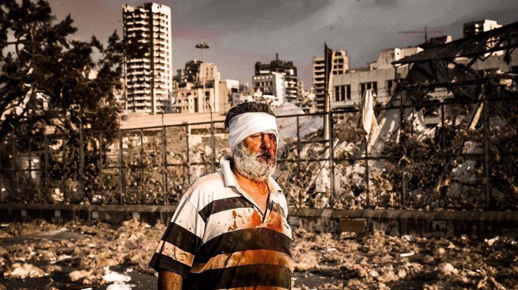 Взрывы в Бейруте/ Фото: "Украина Сейчас"