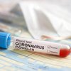 В Украине снизилась заболеваемость коронавирусом