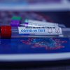 "Все равно лекарств нет": врач отправил домой пациента с коронавирусом 