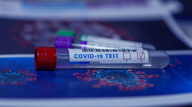 Тест на коронавирус / Фото: Pixabay