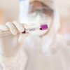 Препараты от коронавируса: ученые назвали два эффективных средства 