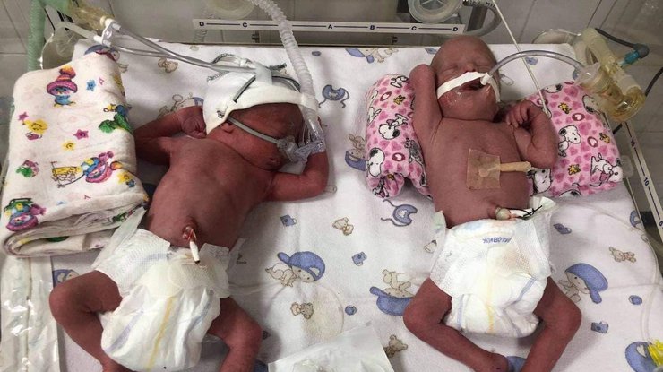 Новорожденные малыши / Фото:ua-reporter.com