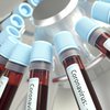 На украинцах будут испытывать китайские и немецкие препараты от коронавируса 