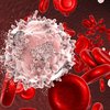 Симптомы "смерти": обнародованы новые признаки рака крови