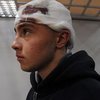 ДТП в Харькове: 16-летний фигурант признан вменяемым