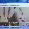 У Києві масово отруюють собак: кому нашкодили чотирилапі?