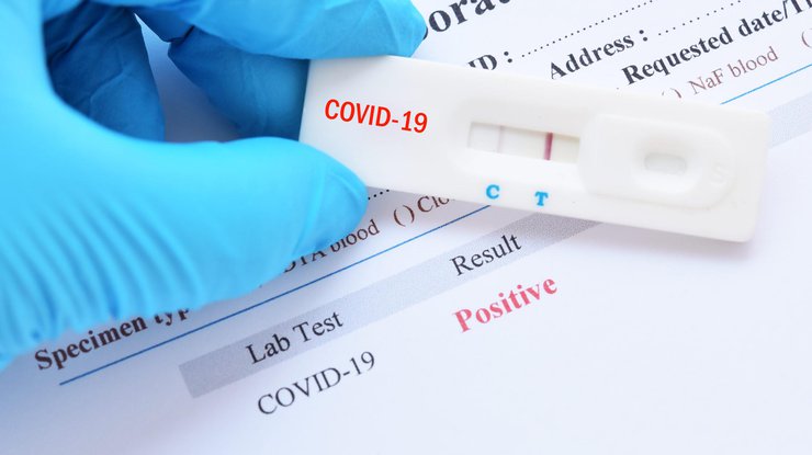 Фото: тест на коронавирус / promedicina.clinic