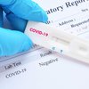 Во Франции начнут продавать тесты на коронавирус