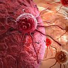 Медицина празднует победу: "убита" распространенная мутация рака