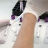В Украине научились прогнозировать осложнения коронавируса по крови