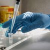 Антитела не нужны: в США утвердили иновационный тест на коронавирус