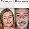 "Мама собирала зубы на асфальте": в центре Киева пенсионерка сбила и на скорости переехала девушку 