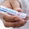 В Украине резко упало число новых случаев коронавируса: статистика на 3 мая