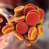 Тромбоз после коронавируса: обнародована невероятная причина 