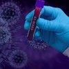 Потеря вкуса и обоняния: ученые сделали невероятное заявление о коронавирусе