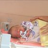 Медики Чернівців поділилися досвідом порятунку передчасно народжених малюків