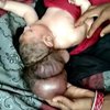 В Индии ребенок родился с тремя головами (фото) 
