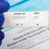 "Дельта"-штамм коронавируса в Украине: где можно сделать тест