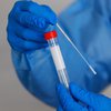 Китай просит ВОЗ расследовать утечку коронавируса из лабораторий США