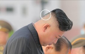 Загадочные пятна на голове Ким Чен Ына переполошили пользователей сети (фото)
