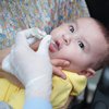 В Украине зафиксирован второй случай опаснейшей детской болезни