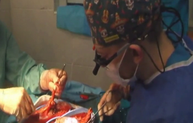 На Волині медики успішно провели дві трансплантації нирок від посмертного донора