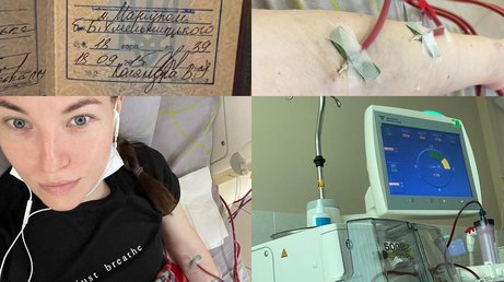 Оксана з Маріуполя потребує трансплантації нирок: єдину надію на гроші від продажу квартири знищили окупанти 
