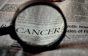 Хто найбільше ризикує захворіти на рак: відповідь онкологів