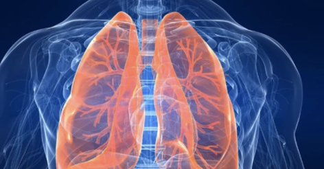 Як лікується туберкульозу: в МОЗ пояснили схему