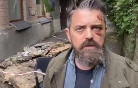 У Києві балкон впав на американського режисера