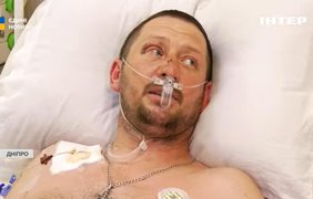 Втратив обидві ноги, але вже в реанімації будує плани: історія воїна