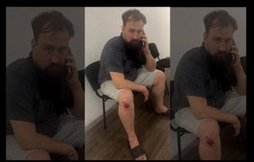 Відомий волонтер Денис Кошельник у стані сп’яніння потрапив у ДТП