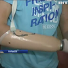 В Харькове ветерану без рук изобрели уникальные протезы