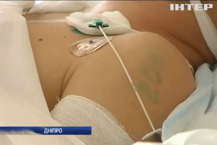 В Дніпрі медики борються за життя поранених на Донбасі бійців