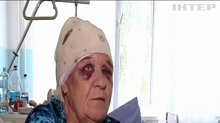 В Черкасской области из-за урагана пострадали 48 человек