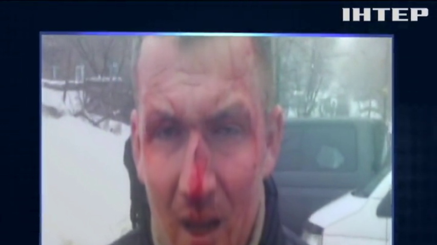 В Киеве избили депутата Юрия Левченко