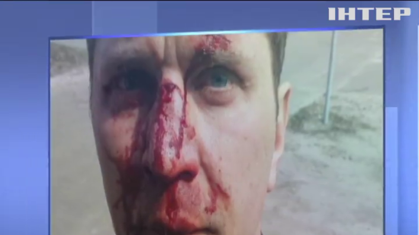 В Киеве на пороге медучреждения жестоко избили врача