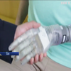 Американці розробили революційний протез людської руки