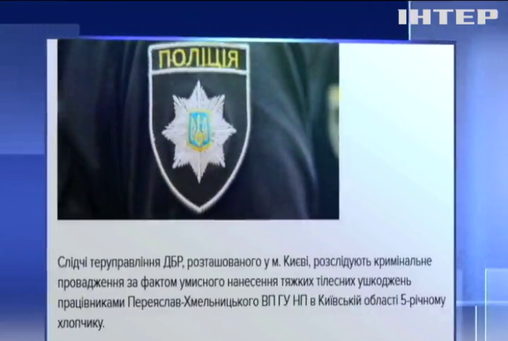 На Київщині поліцейські стріляли у п'ятирічну дитину